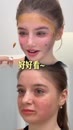 Post Video