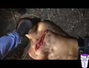 Post Video