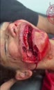 Post Video