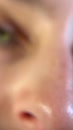 Post Video