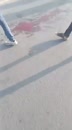 Post Video