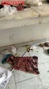 Post Video