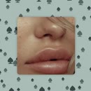 Post Video