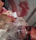 Post Video